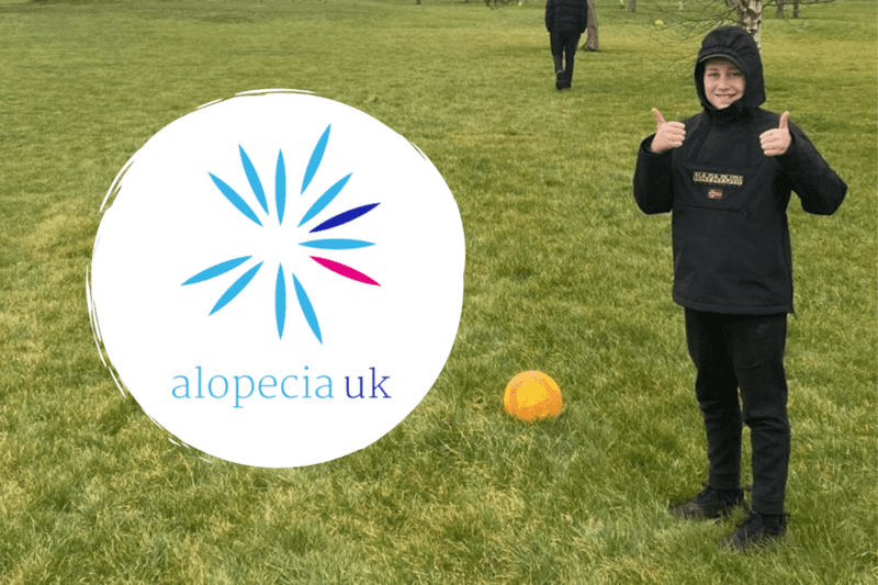 Dylan raises £385 for Alopecia Charity