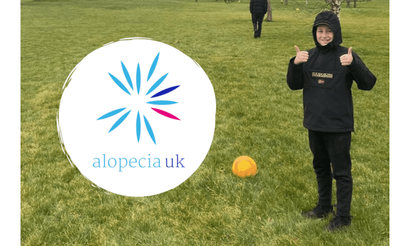Dylan raises £385 for Alopecia Charity